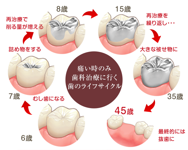 歯のサイクル